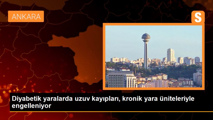 Diyabetik yaralarda uzuv kayıpları, kronik yara üniteleriyle engelleniyor